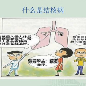 咳嗽2周以上千万别疏忽！这些结核病防治知识要知道